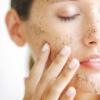 Kā ātri noņemt, nekā balināt, ārstēt sejas ādu mājās