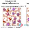 Leukocytes in the blood: norm and deviations How many leukocytes should there be