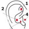 Points on the ear from excess weight