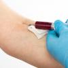 Vairogdziedzera pārbaude Veiciet asins analīzi vairogdziedzera hormoniem