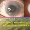 Glaucoma presentation