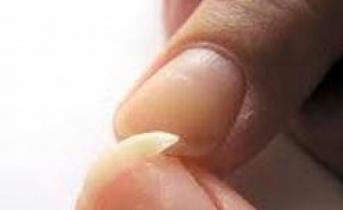 Broken nail: why you dream, interpretation of sleep